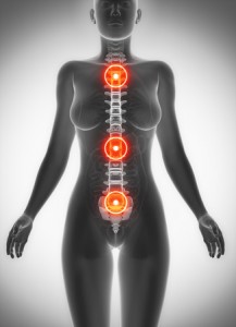 41402735 - spine antomy female scan pain concept