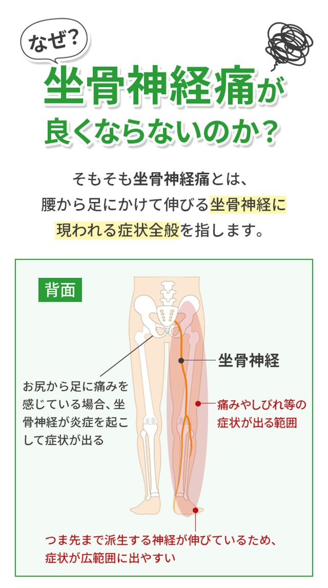 なぜ坐骨神経痛が良くならないのか？